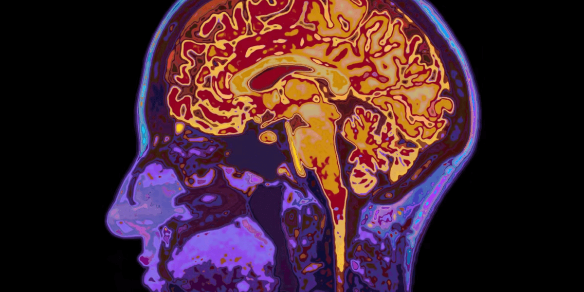 Co dzieje się w mózgu, gdy ulegamy pokusie? Neurobiologia korupcji politycznej
