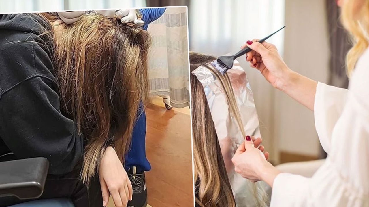 She dyed her hair and ended up in the hospital!