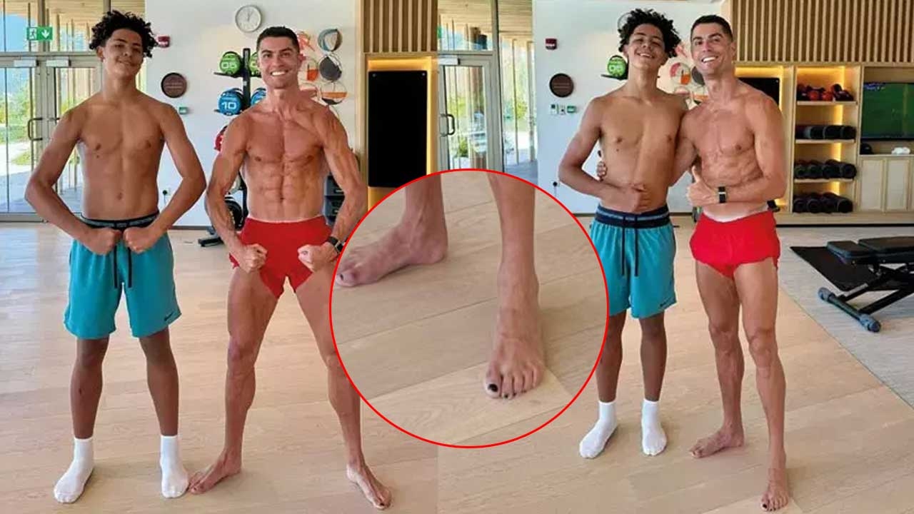 Warum trägt Ronaldo schwarzen Nagellack auf den Fußnägeln?