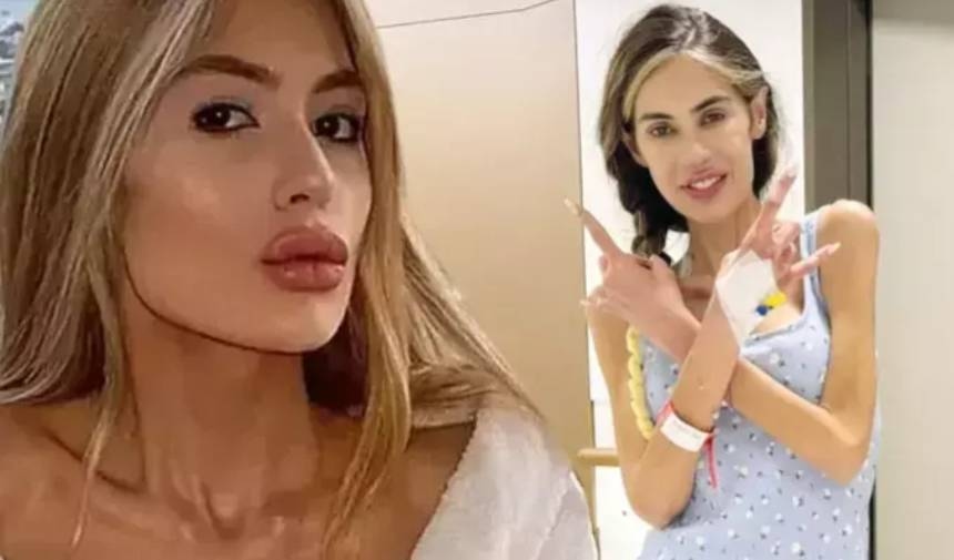 Nihal Candan 29 kilonun altına düştü! Yoğun bakıma alındı